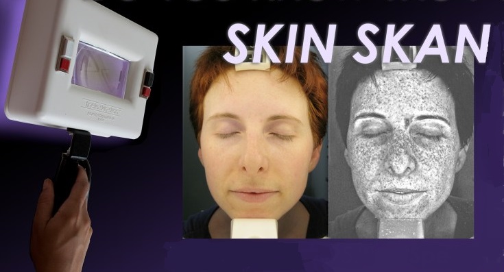 SKIN-SKAN 2